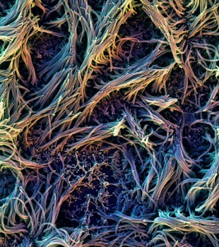 Emulate Lung-Chip