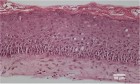 Terminally Differentiated Human Skin Equivalents
