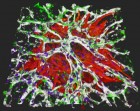 Microvascularised heart-on-a-chip