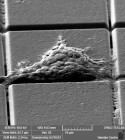 Triple Negative Breast Cancer cells attachment on novel bio-chips for real-time detection of tumour acidification (by Melina Beykou and Lewis Keeble)
